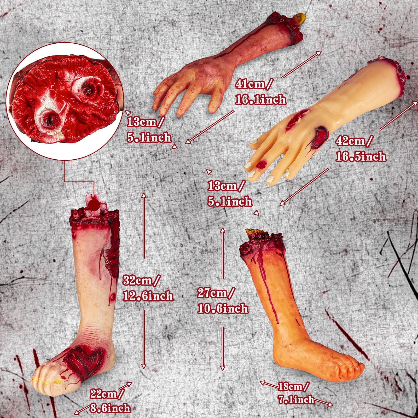 Pipilily size comparison of multiple limbs for accurate placement planning